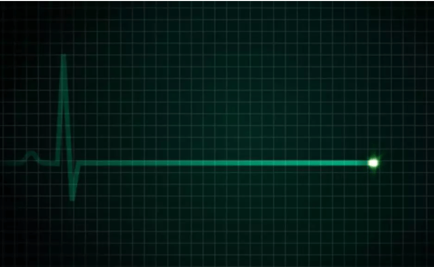 Encephalogramme Plat