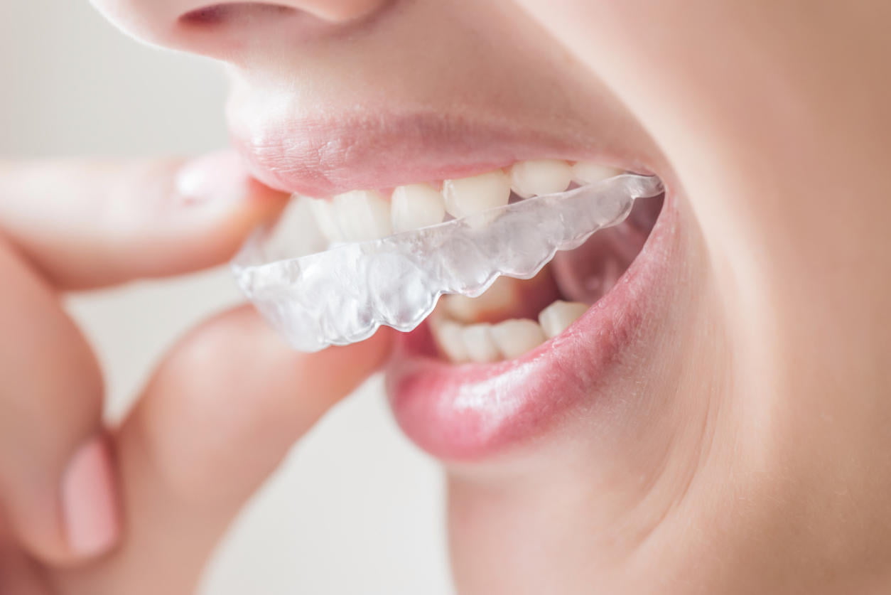 Orthodontiste%20sourire%20parfait
