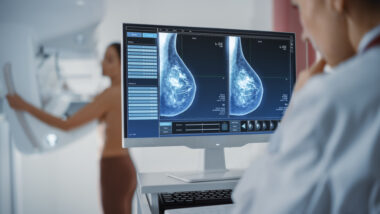 Cancer du sein : 1 549 euros de reste à charge, un système à deux vitesses