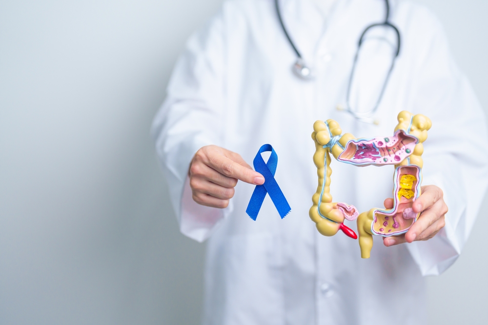Cancer colorectal : une campagne choc pour relancer le dépistage