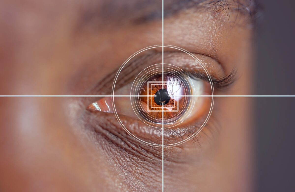 Laser,and,glaucoma,eye,surgery,concept,,close,up,of,eye
