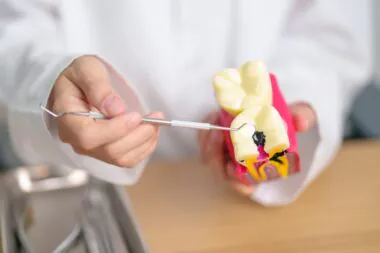 Caries dentaires : des Néandertaliens auraient pratiqué une opération il y a 60.000 ans